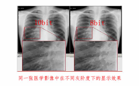 灰階顯示器使用上有什么注意點(diǎn)